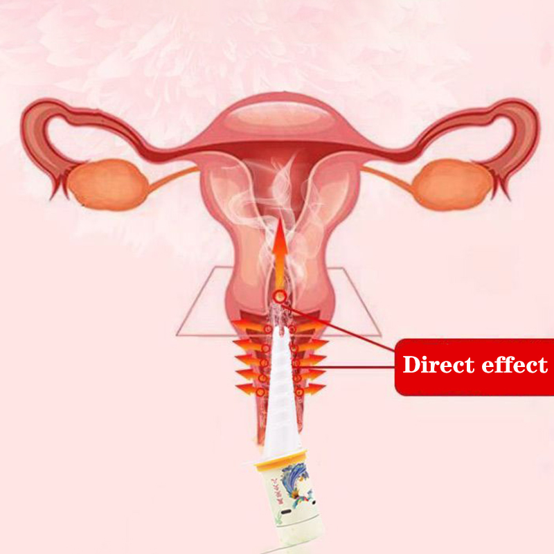 Women-Only Moxibustion Tool fo - đánh giá và giá Therapy Health And Wellness