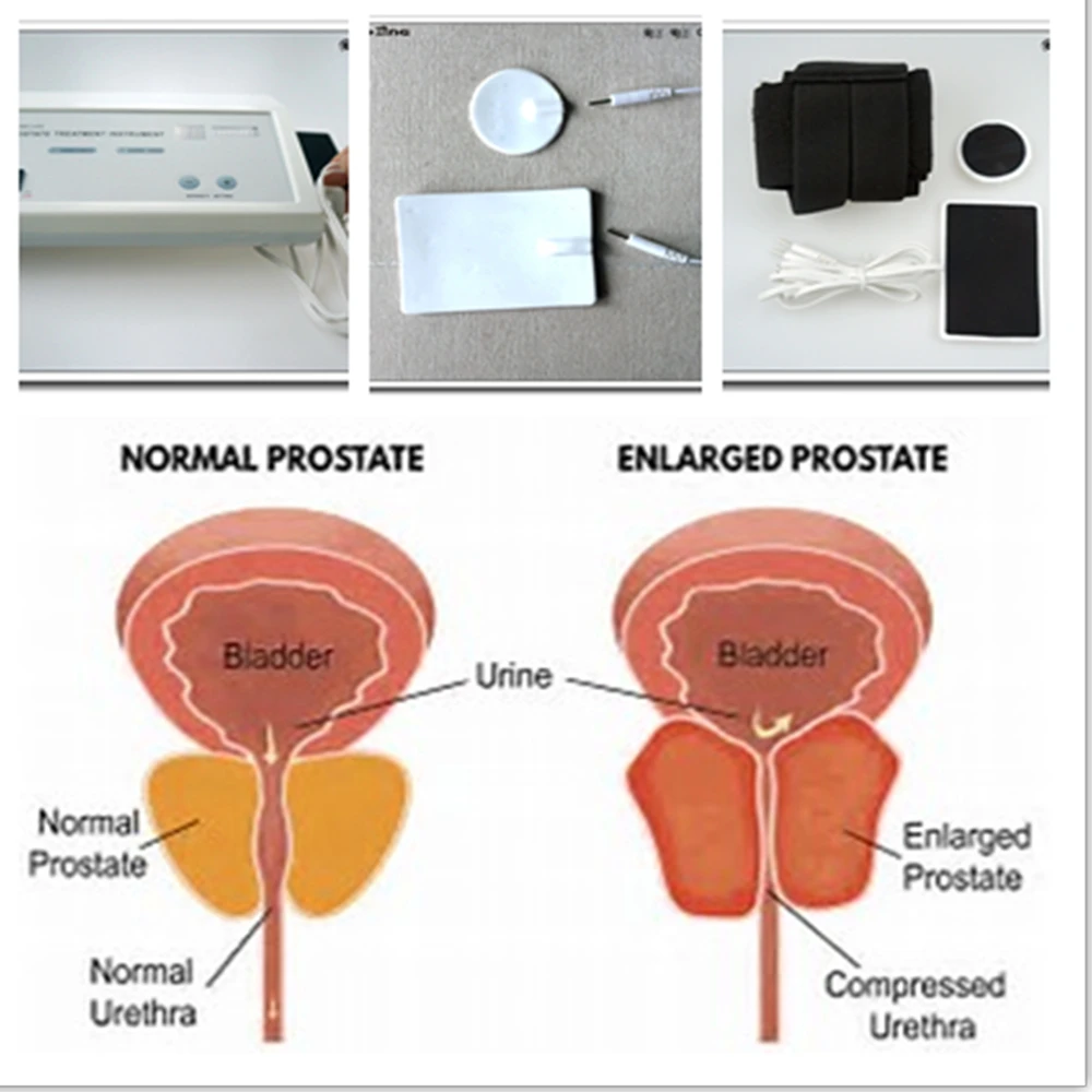Powerful Prostate Massager Pul - đánh giá và giá Therapy Health And Wellness